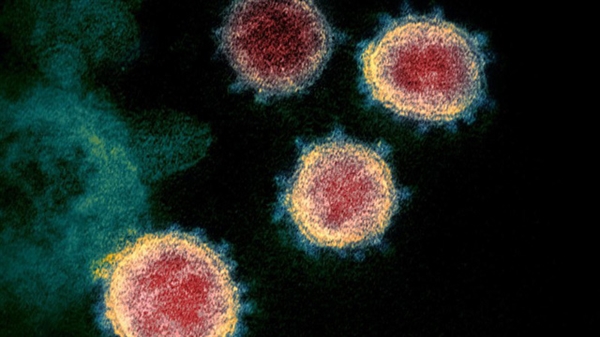 WHO cảnh báo Virus SARS CoV-2 có thể sẽ trở thành một virus tồn tại mãi với con người. Ảnh: AP