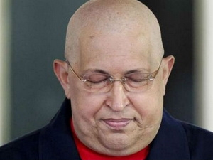 Tổng thống Chavez bị biến chứng nghiêm trọng sau phẫu thuật ung thư