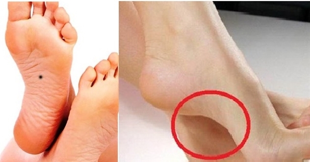 Xem tướng bàn chân biết ngay giàu sang sắp ập đến hay còn khó khăn