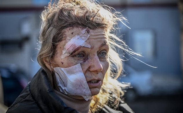 Những bức ảnh ghi lại cảnh Nga đã "phá vỡ" cuộc sống thường nhật tại Ukraine