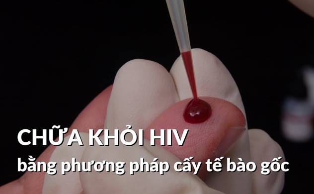Chữa thành công HIV bằng phương pháp mới