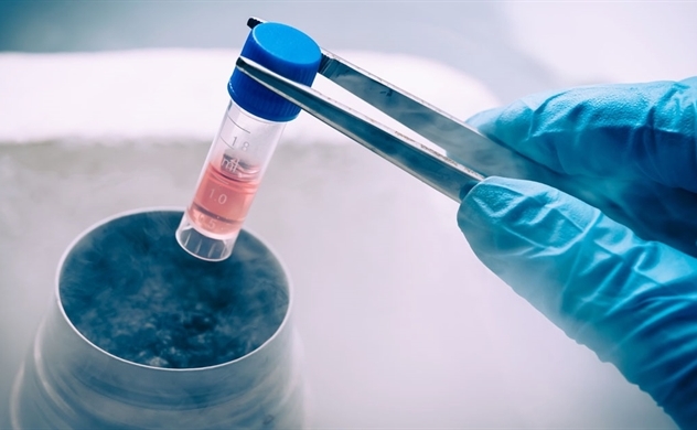 Nghiên cứu bơm tế bào gốc cho phụ nữ hiếm muộn